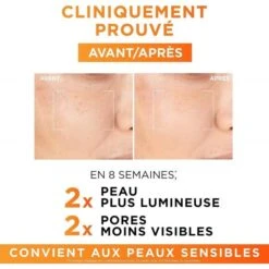 L'Oreal Sérum 12% Vitamine C Pure + Acide... -Magazinul Boutique serum 12 vitamine c pure acide salicylique vitamine e revitalift clinical de loreal paris 2